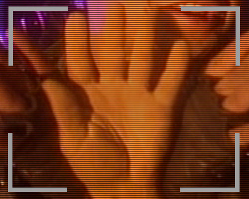 Athlete's Hand